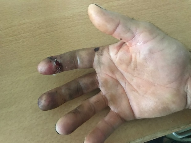 Arad: Anchetă la Penitenciarul Arad, după ce agent supraveghetor a fost atacat cu un ciob de sticlă de un deținut agresiv