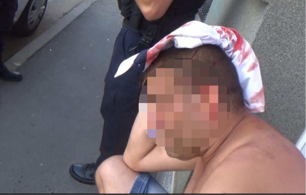 Arad: AUDIO Bărbat lovit cu cărămida în cap, chiar în plină stradă, la Arad. Motivul