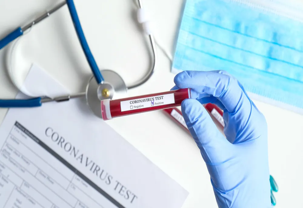 14 cazuri noi de CORONAVIRUS, la Arad. Alte 10 persoane au fost reconfirmate pozitiv